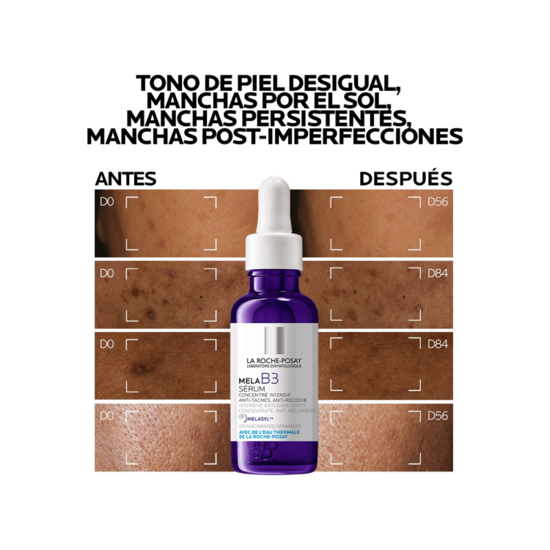 Sérum Concentrado Mela B3 La Roche-Posay Antimanchas 30ml con Melasyl y 10% Niacinamida Previene la Reaparición